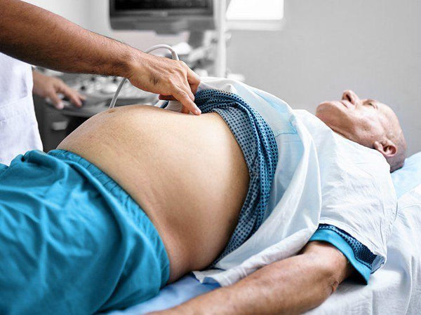 10 Common causes of ascites - almoes.inc