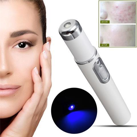 Blue Light Therapy Acne Laser Pen Soft Scar Wrinkle Removal Treatment Device Skin Care Beauty Equipment - almoes.inc